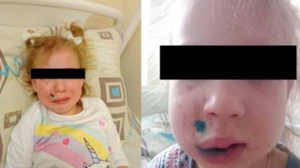 В Брянске возле кафе кане-корсо покусала 4-летней девочке лицо