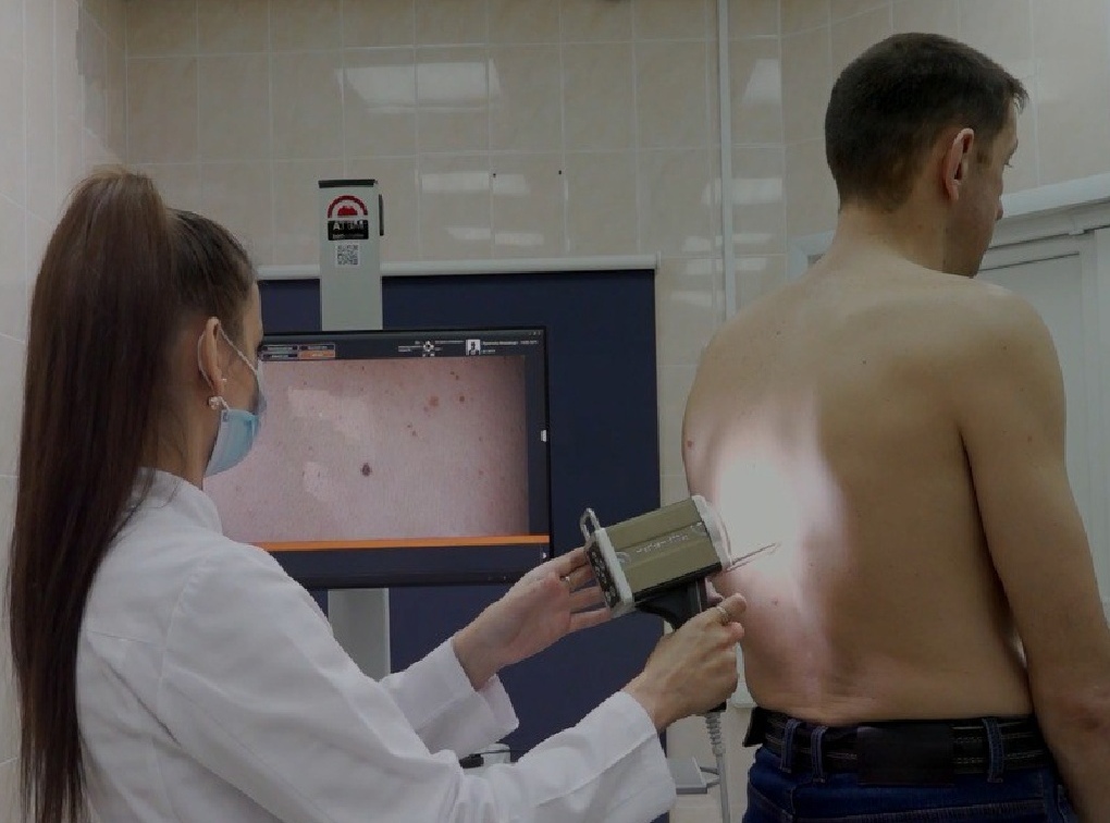 С начала года у 97 брянцев выявили злокачественные новообразования кожи
