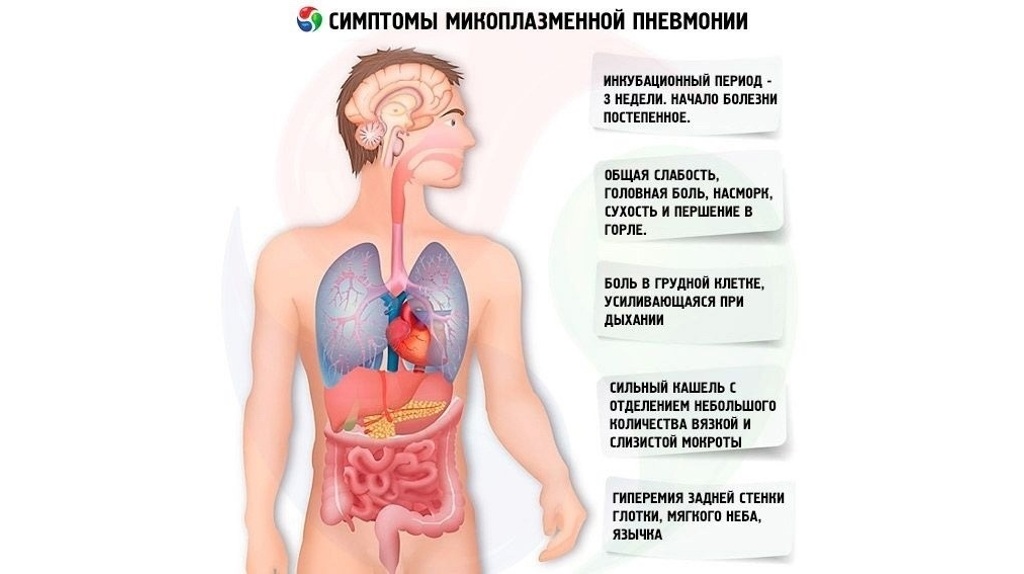 Не просто покашливание: в России вспышка микоплазменной инфекции